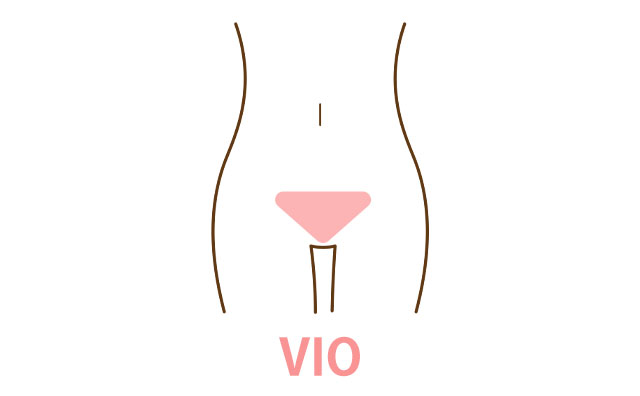 VIO脱毛